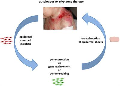 Gene Replacement Therapies for Genodermatoses: A Status Quo